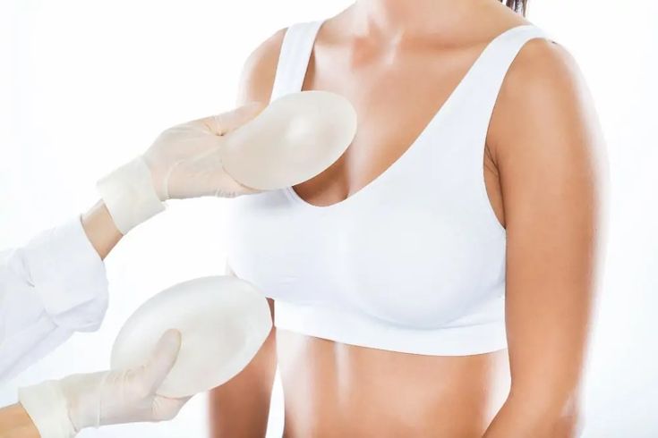 Breast augmentation