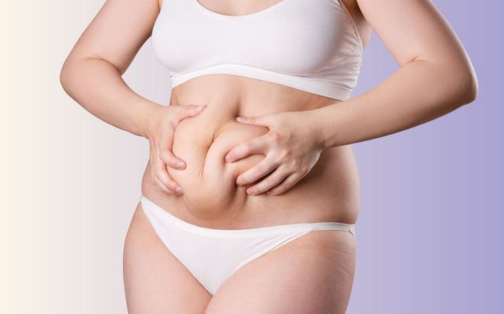 Liposuction